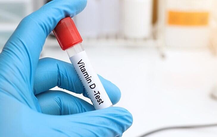 Zašto je važno redovito kontrolirati razinu vitamina D u krvi